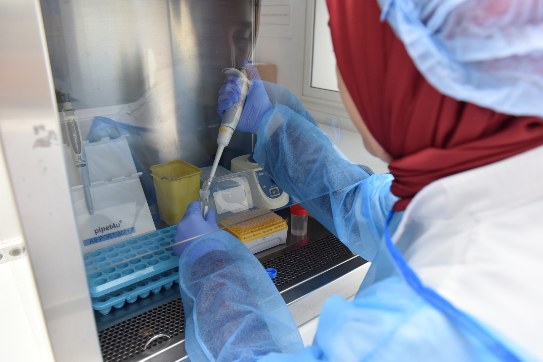 Hotte PCR utilisée pour les analyses de diagnostic prénatal