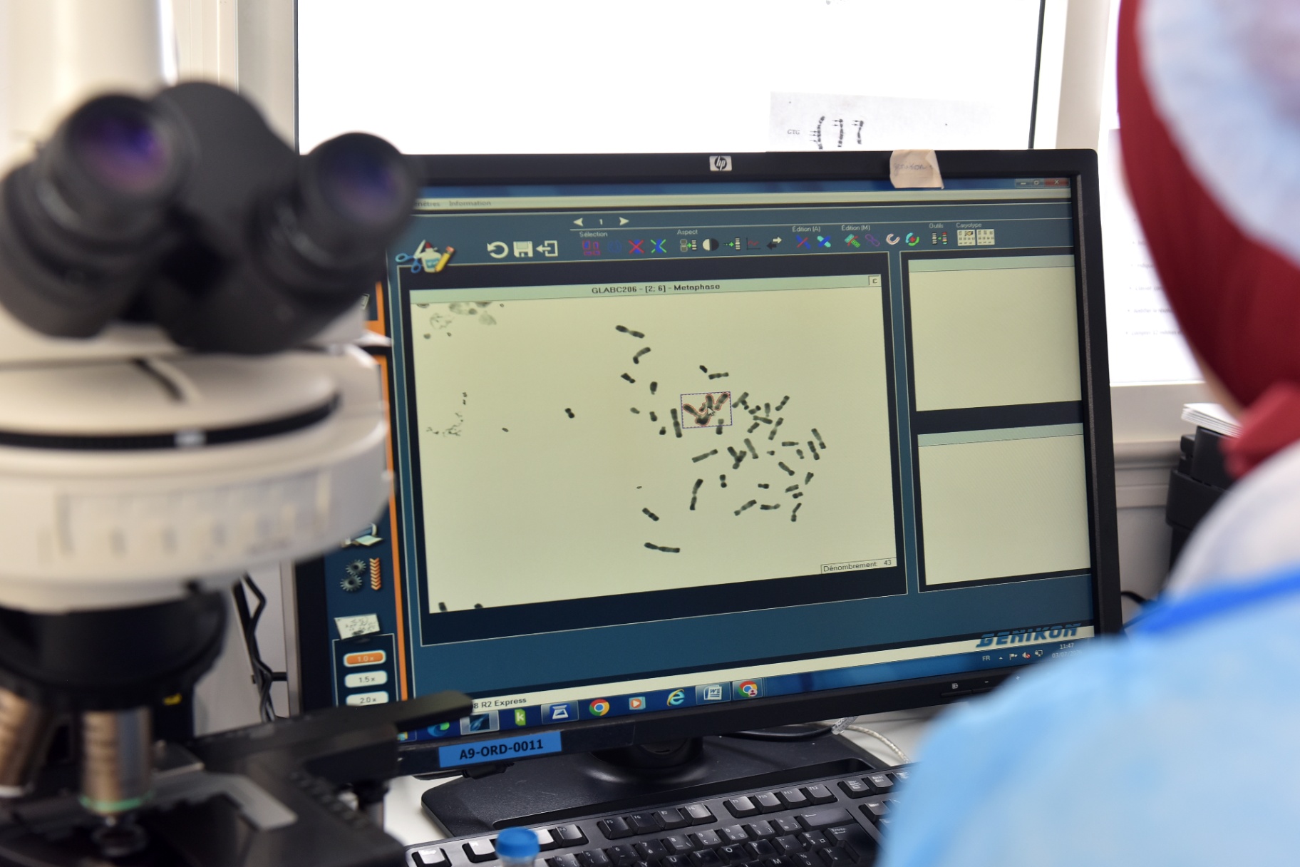 Analyse de caryotype en cytogénétique à G Lab