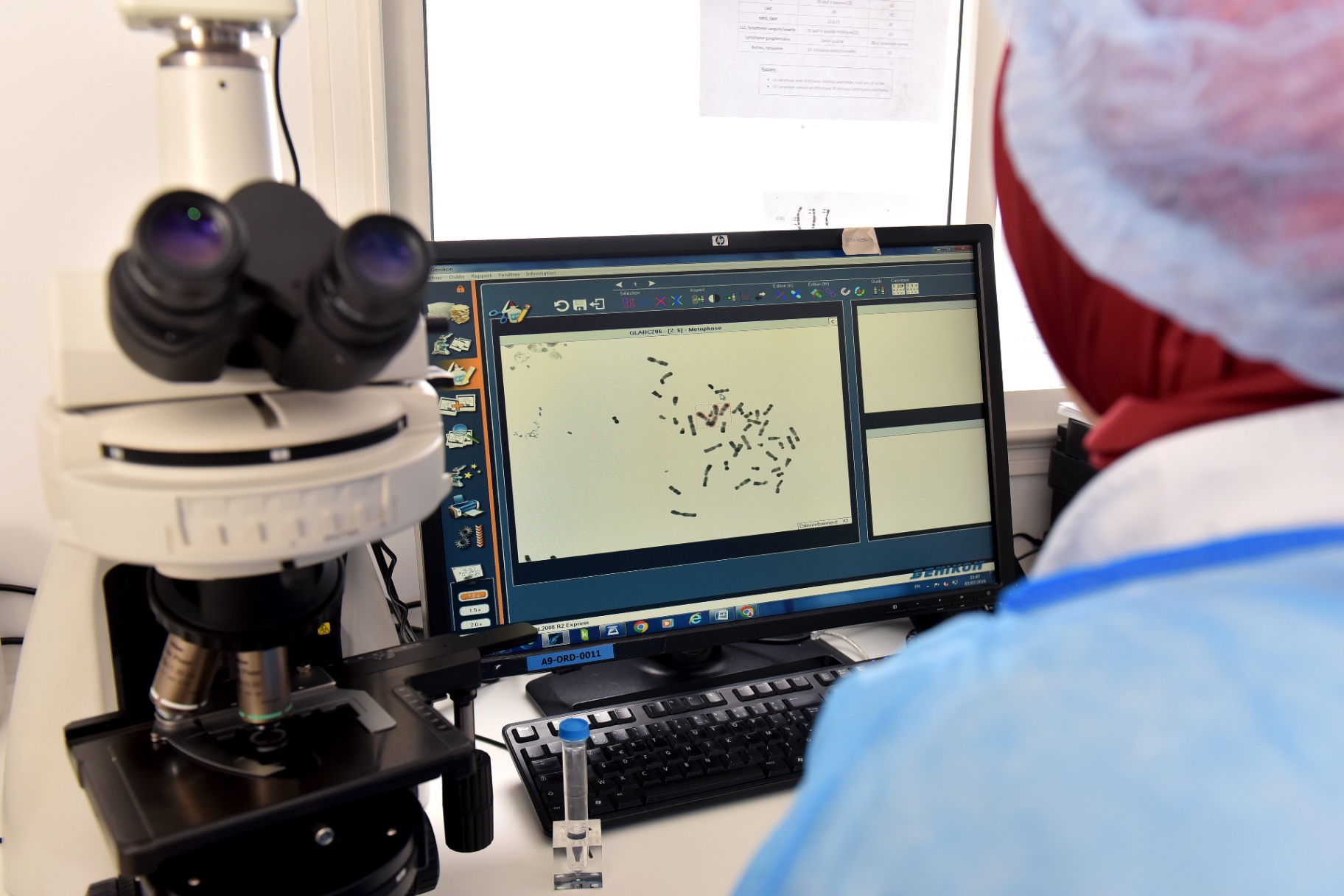 Analyse caryotype cytogénétique